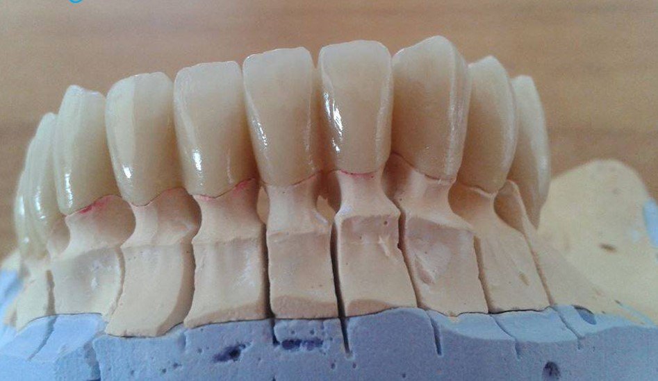 eyraimidhs-odontotexniko-ergasthrio-athina-010..