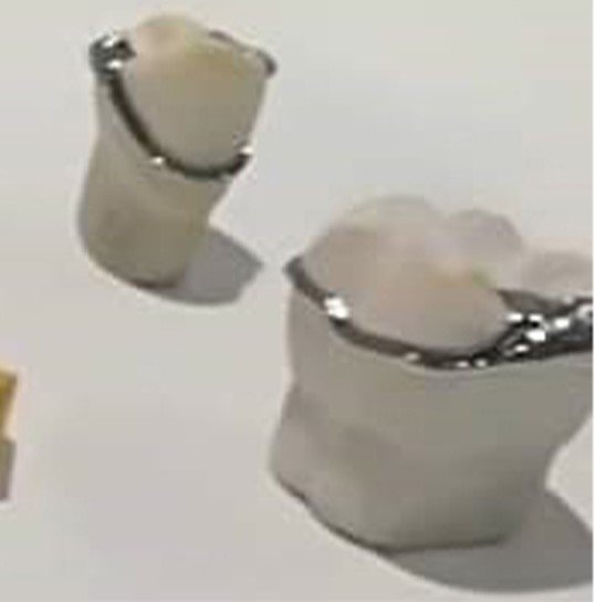 eyraimidhs-odontotexniko-ergasthrio-athina-03..