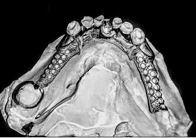 eyraimidhs-odontotexniko-ergasthrio-athina-04.