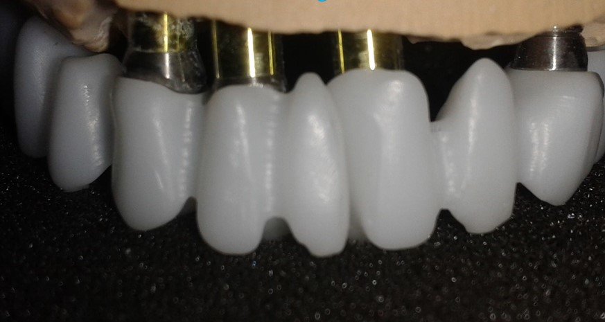 eyraimidhs-odontotexniko-ergasthrio-athina-05..