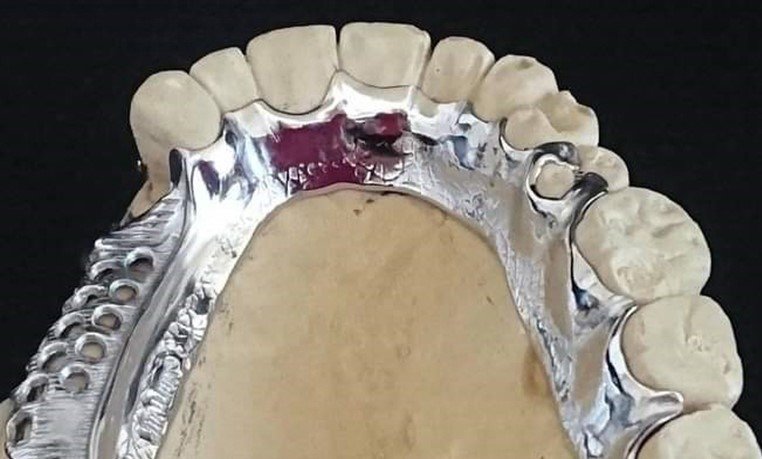 eyraimidhs-odontotexniko-ergasthrio-athina-09..